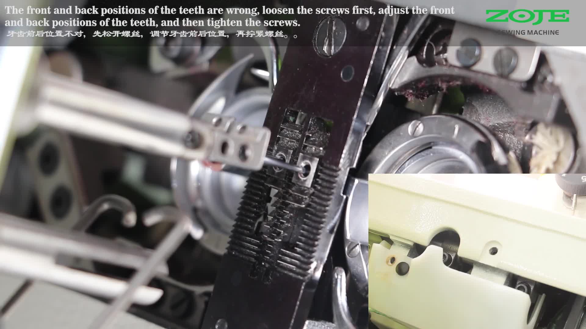 牙齿前后位置调整