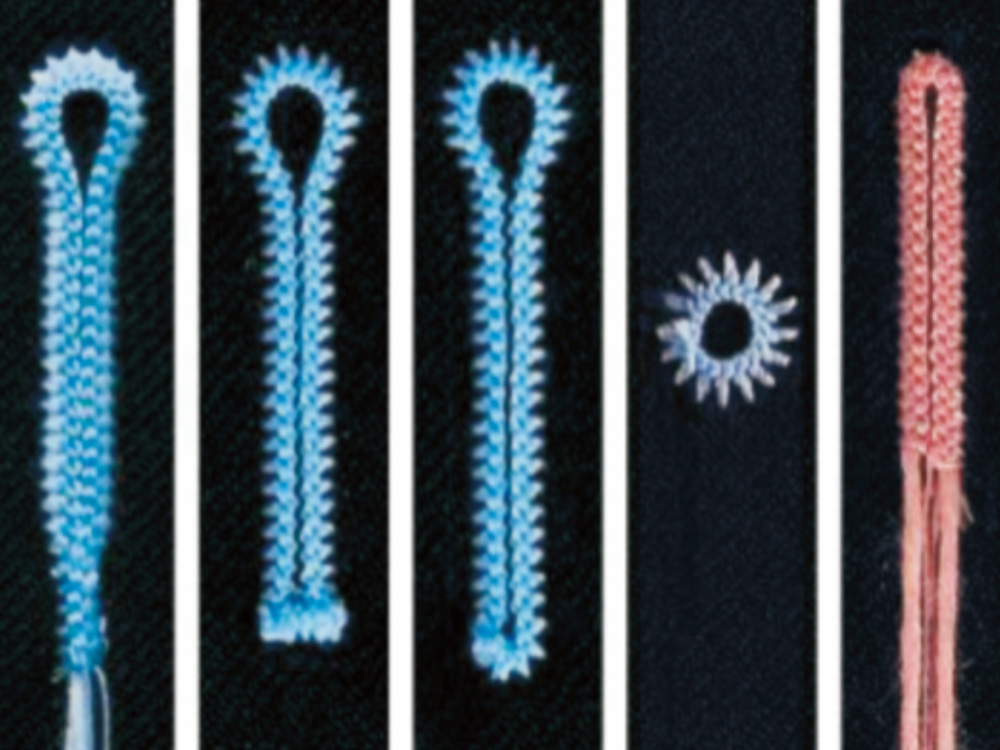 闭环系统提高图案精确性和美观度